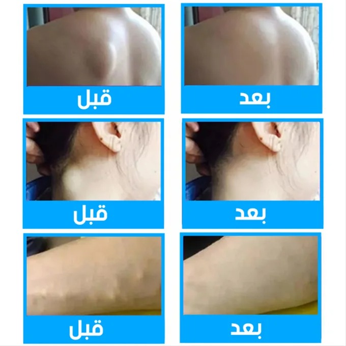 POLIMAX CRÈME